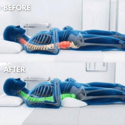 Minvia Pro Sciatica Pillow™